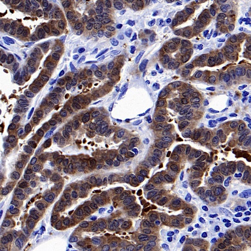 ATG12 Recombinant Rabbit mAb (S-1143-209)