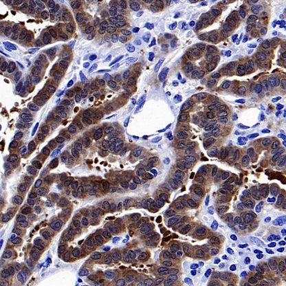 ATG12 Recombinant Rabbit mAb (S-1143-209)