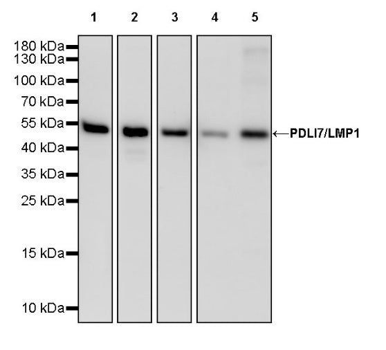PDLI7/LMP1 Recombinant Rabbit mAb (S-2150-68)