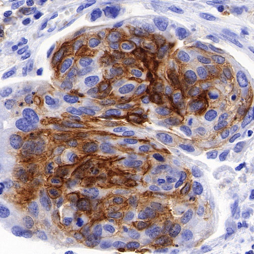 SLC7A5/LAT1 Recombinant Rabbit mAb (S-367-12)