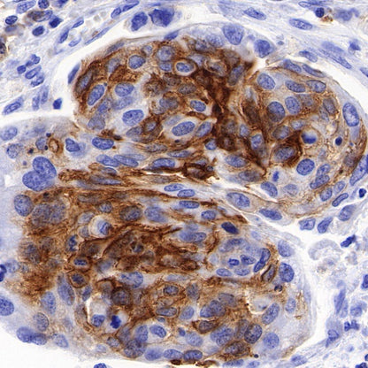 SLC7A5/LAT1 Recombinant Rabbit mAb (S-367-12)