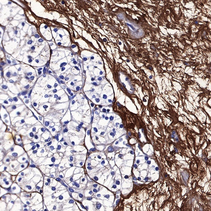 Lumican Recombinant Rabbit mAb (S-247-47)