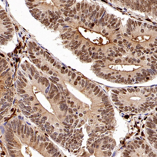 SAMHD1 Recombinant Rabbit mAb (S-2401-25)