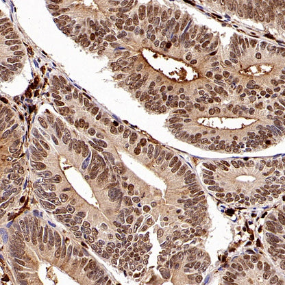 SAMHD1 Recombinant Rabbit mAb (S-2401-25)