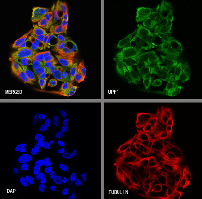 UPF1 Rabbit Polyclonal Antibody