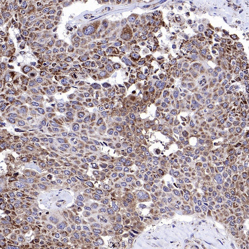 LONP1 Rabbit Polyclonal Antibody