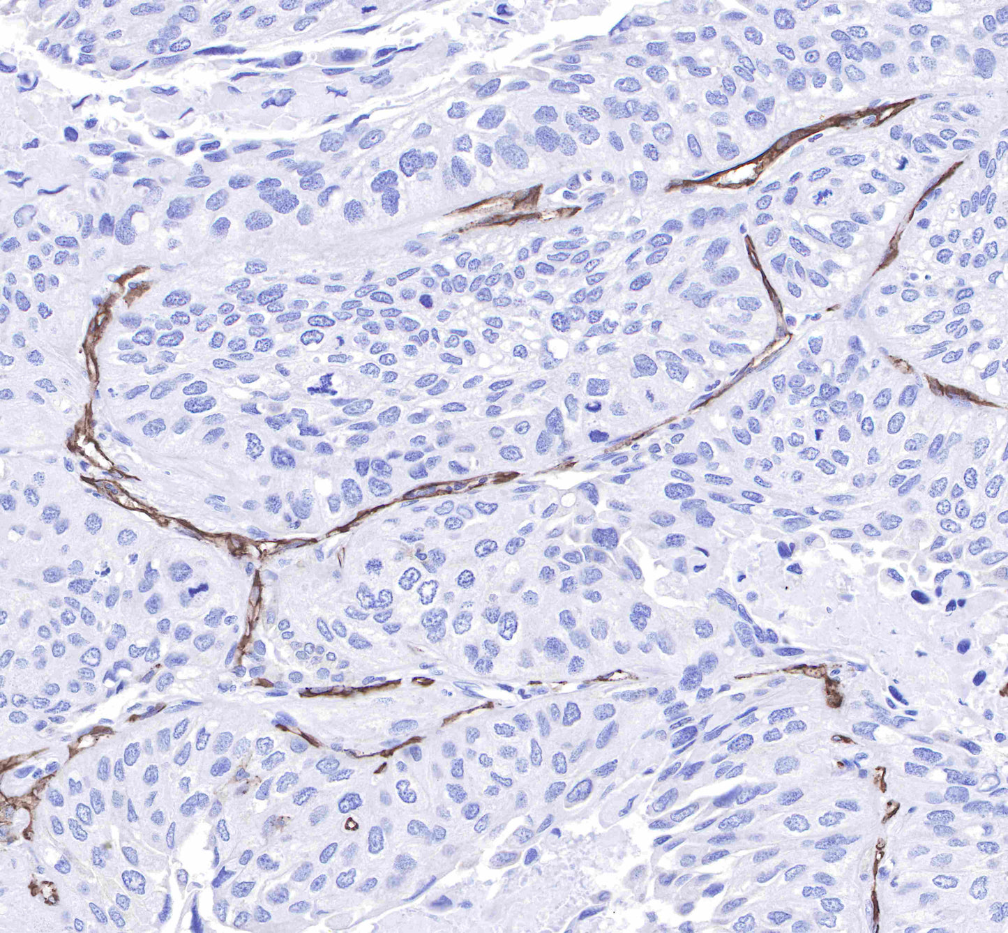 CD31 Recombinant Rabbit mAb,PBS Only (SDT-008-17)