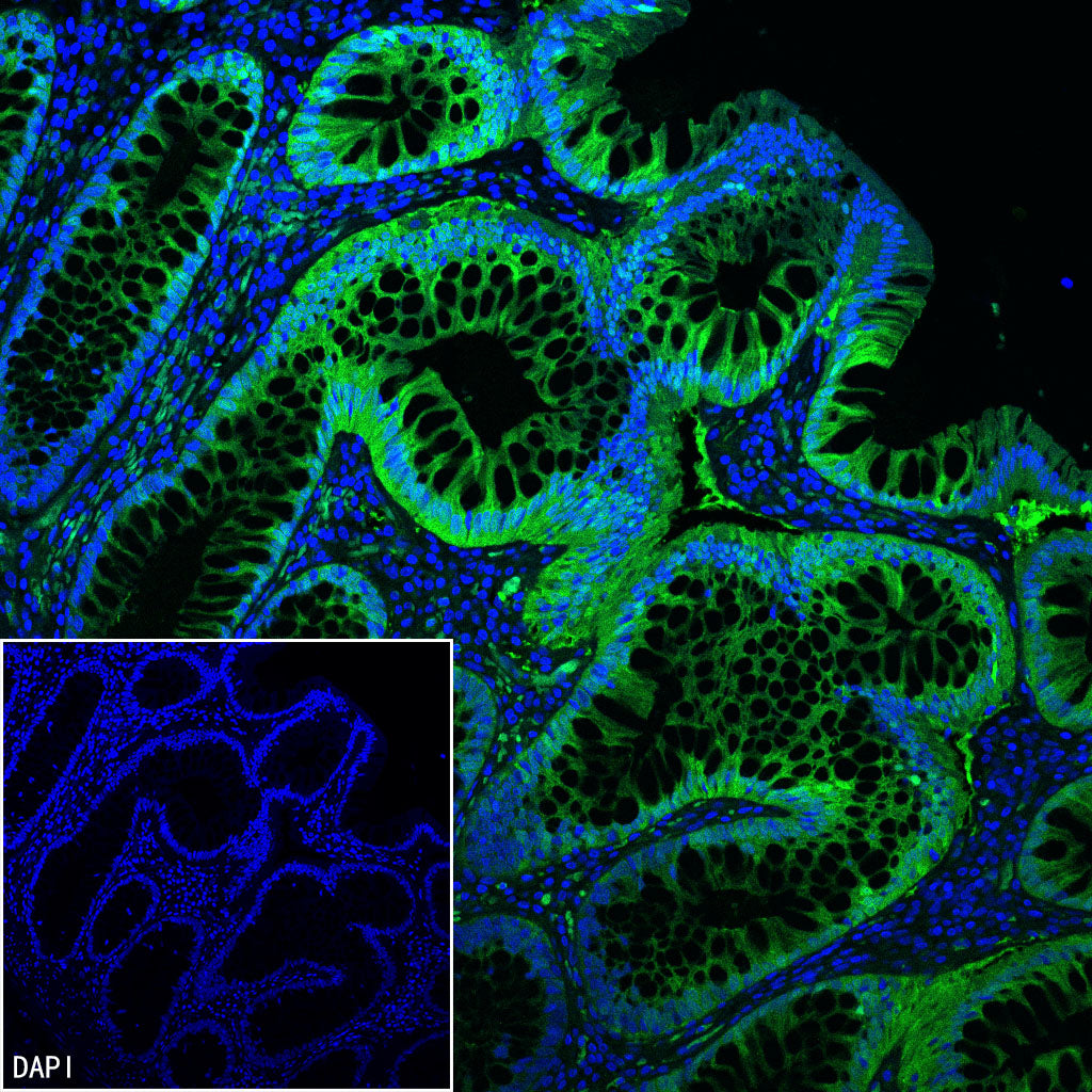 AK1C3 Rabbit Polyclonal Antibody