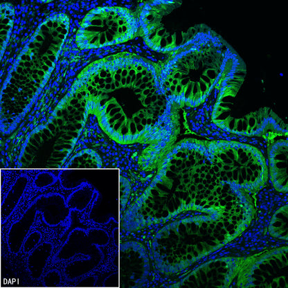 AK1C3 Rabbit Polyclonal Antibody