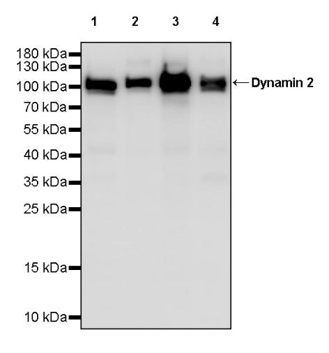 Dynamin 2 Recombinant Rabbit mAb (S-1751-209)