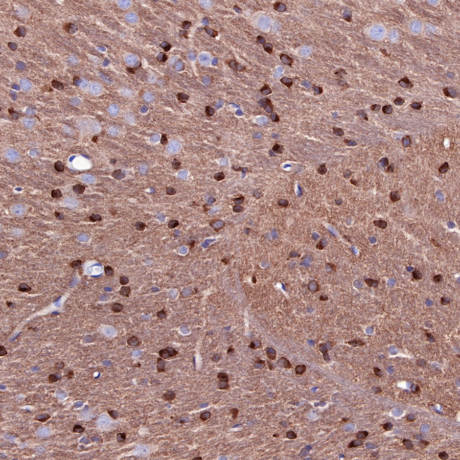 Tau Recombinant Rabbit mAb (SDT-171-67)