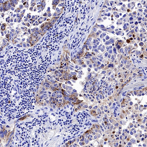 DPP4 Recombinant Rabbit mAb (S-1631-130)