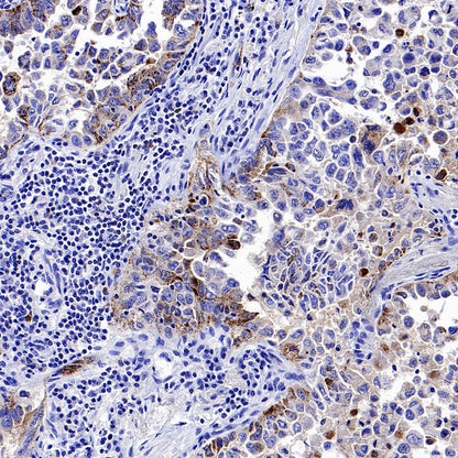 DPP4 Recombinant Rabbit mAb (S-1631-130)