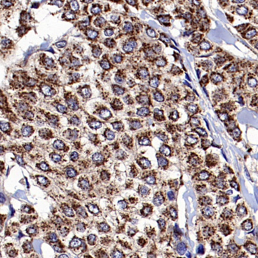 Fumarate hydratase Rabbit Polyclonal Antibody