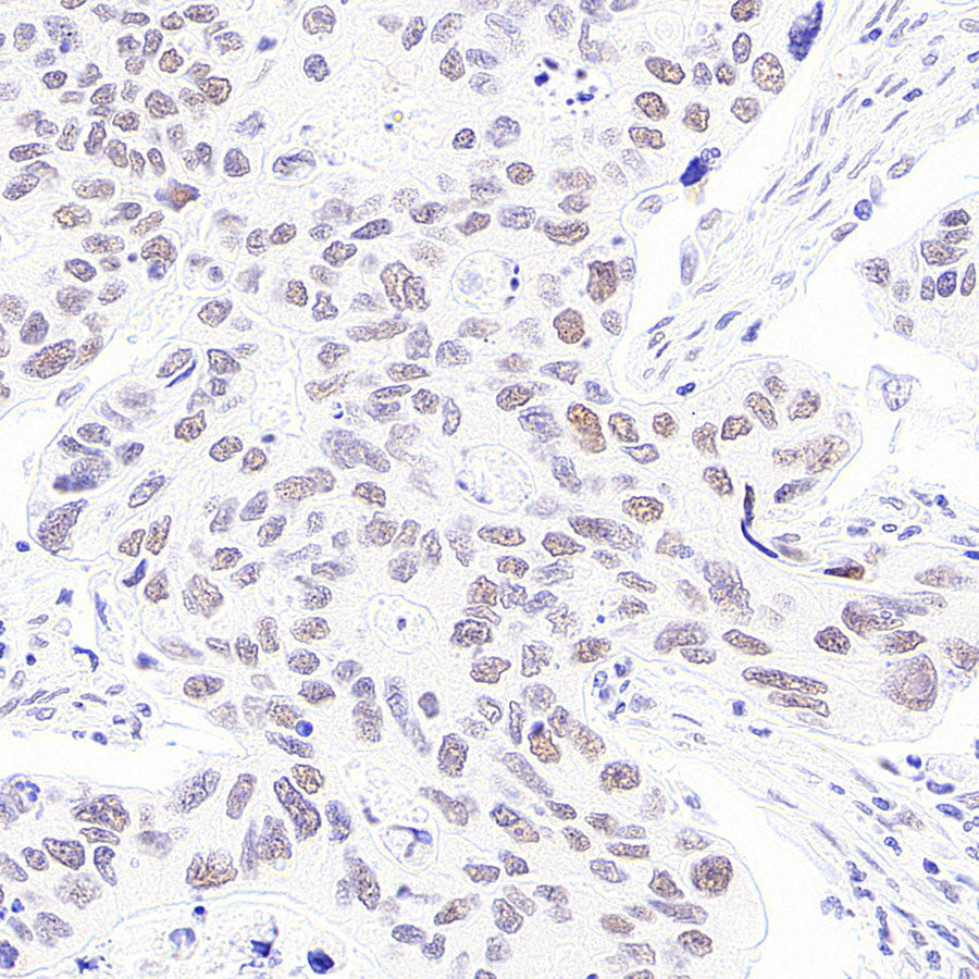 BAP1 Recombinant Rabbit mAb (S-6199)