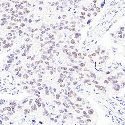 BAP1 Recombinant Rabbit mAb (S-6199)
