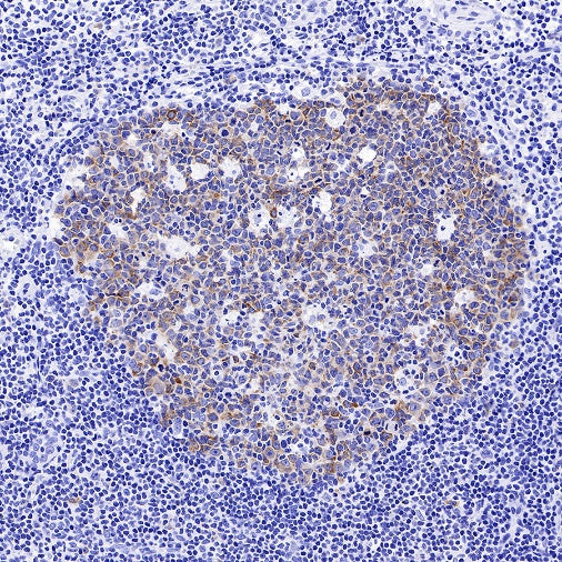 IMP-3 Recombinant Rabbit mAb (S-439-10)
