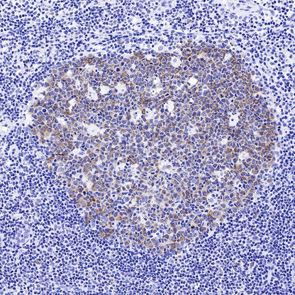 IMP-3 Recombinant Rabbit mAb (S-439-10)