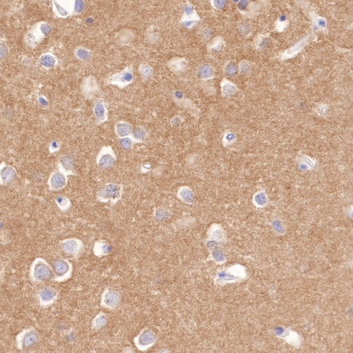 S-RMab® Pan Trk Recombinant Rabbit mAb (SDT-512-5)