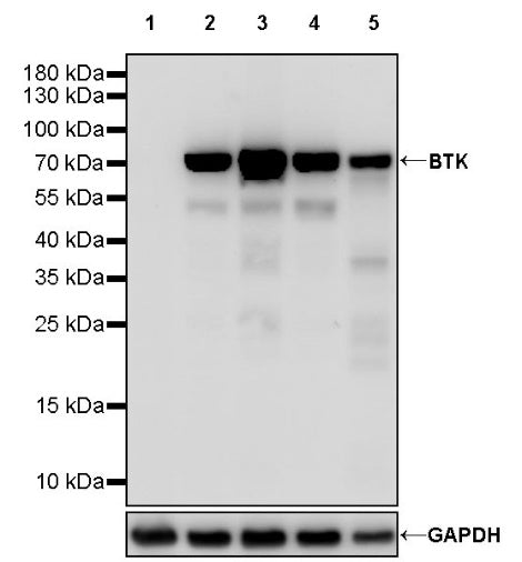 BTK Recombinant Rabbit mAb (SDT-2105-37)