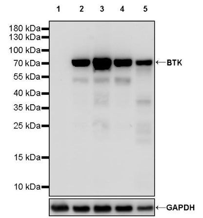 BTK Recombinant Rabbit mAb (SDT-2105-37)
