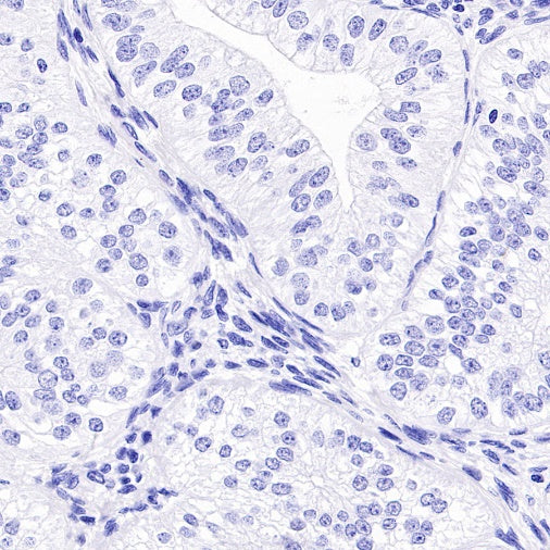 Reg4 Recombinant Rabbit mAb (SDT-1232-23)