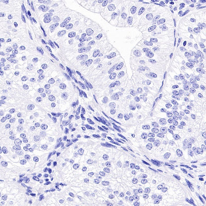 Reg4 Recombinant Rabbit mAb (SDT-1232-23)