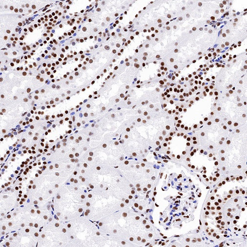 KAP-1 Recombinant Rabbit mAb (S-986-5)