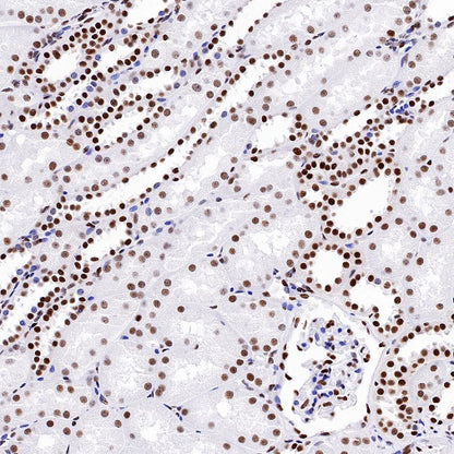 KAP-1 Recombinant Rabbit mAb (S-986-5)