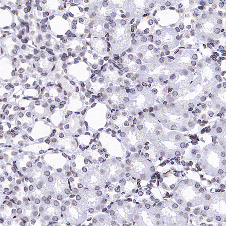 Lamin B1 Recombinant Rabbit mAb (S-5361)