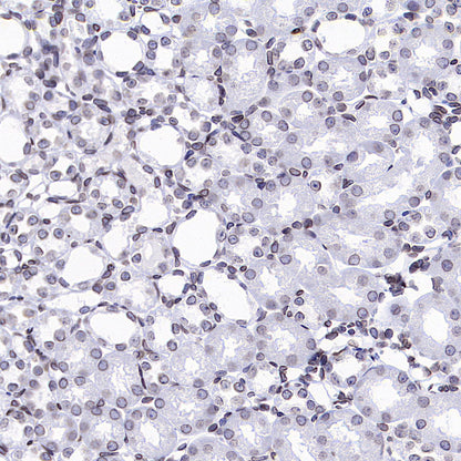 Lamin B1 Recombinant Rabbit mAb (S-5361)