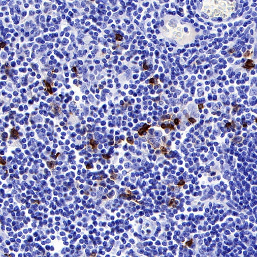 OX-40 Recombinant Rabbit mAb (S-R366)