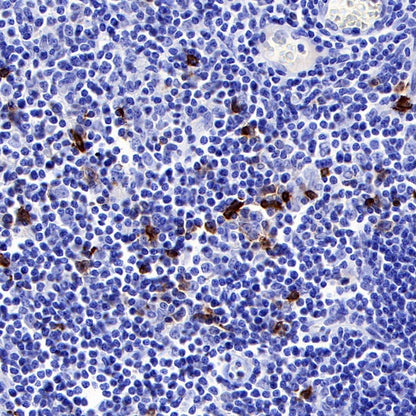 OX-40 Recombinant Rabbit mAb (S-R366)
