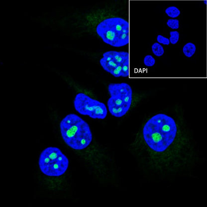 PES1 Recombinant Rat mAb (SDT-R197)