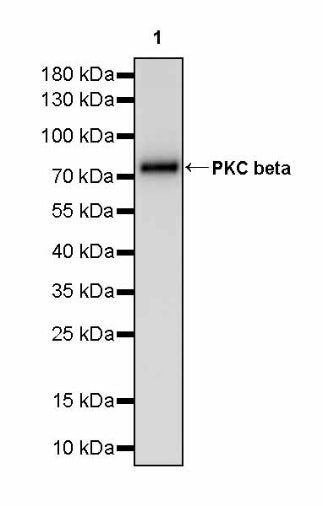 PKC beta Recombinant Rabbit mAb (S-3158-28)