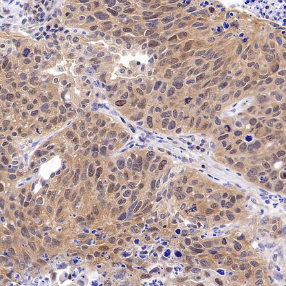 Tug Recombinant Rabbit mAb (S-4377-21)