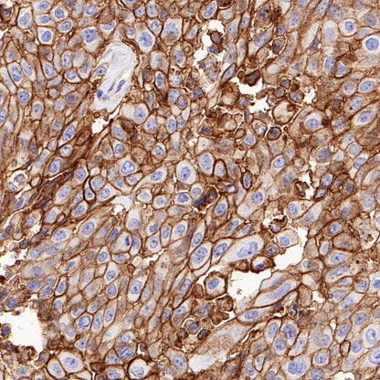 CD98/SLC3A2 Recombinant Rabbit mAb (SDT-2038-19)