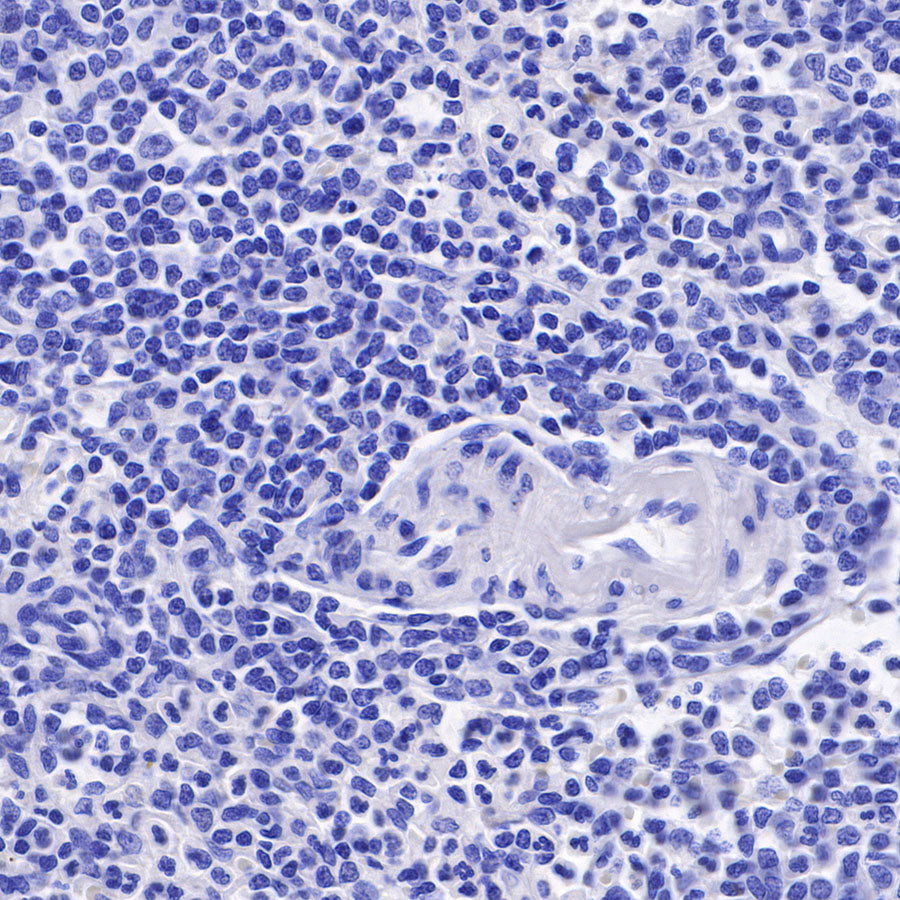 Androgen Receptor Recombinant Rabbit mAb (SDT-R167)