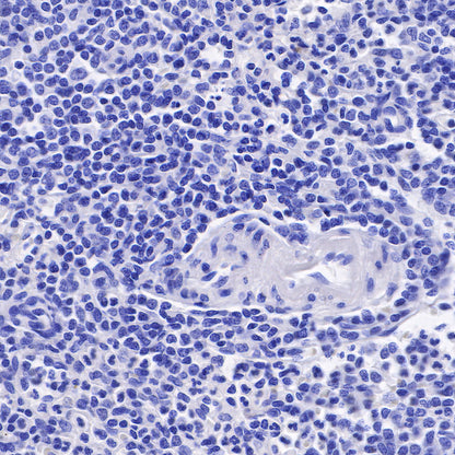 Androgen Receptor Recombinant Rabbit mAb (SDT-R167)