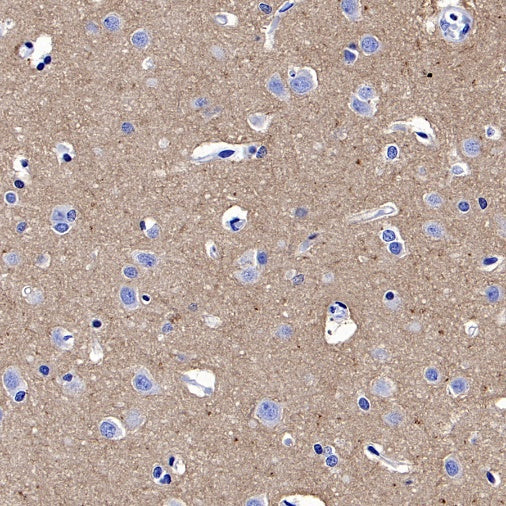 Mouse anti-Human CD90 Antibody (5E10)