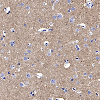 Mouse anti-Human CD90 Antibody (5E10)