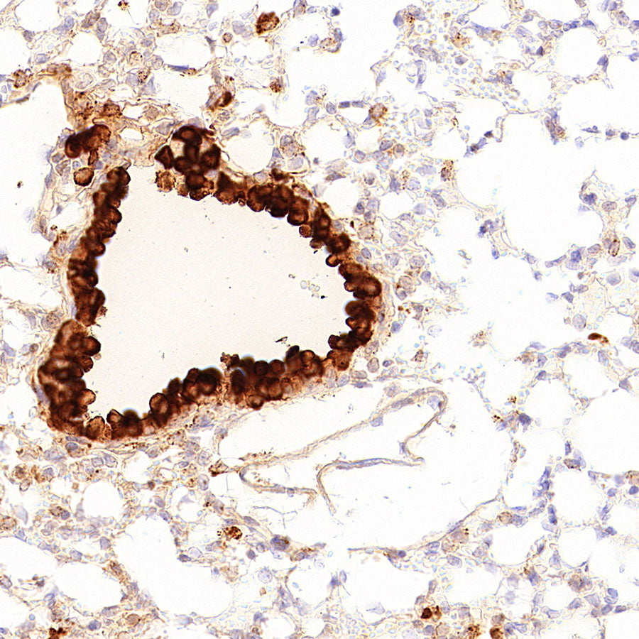 Uteroglobin Recombinant Rabbit mAb (S-6021)