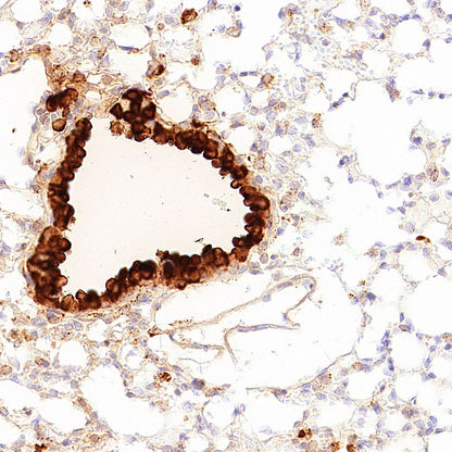 Uteroglobin Recombinant Rabbit mAb (S-6021)