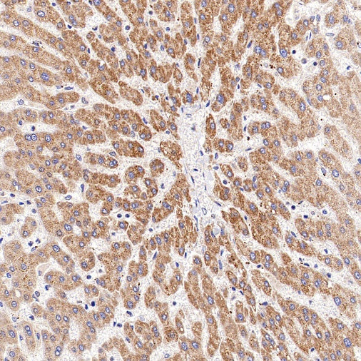 TGFBR2 Recombinant Rabbit mAb (S-1711-55)