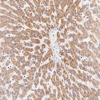 TGFBR2 Recombinant Rabbit mAb (S-1711-55)