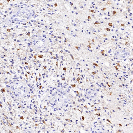 P2ry12 Recombinant Rabbit mAb (SDT-3134-52)
