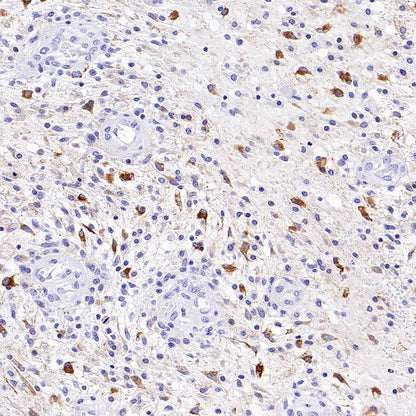 P2ry12 Recombinant Rabbit mAb (SDT-3134-52)