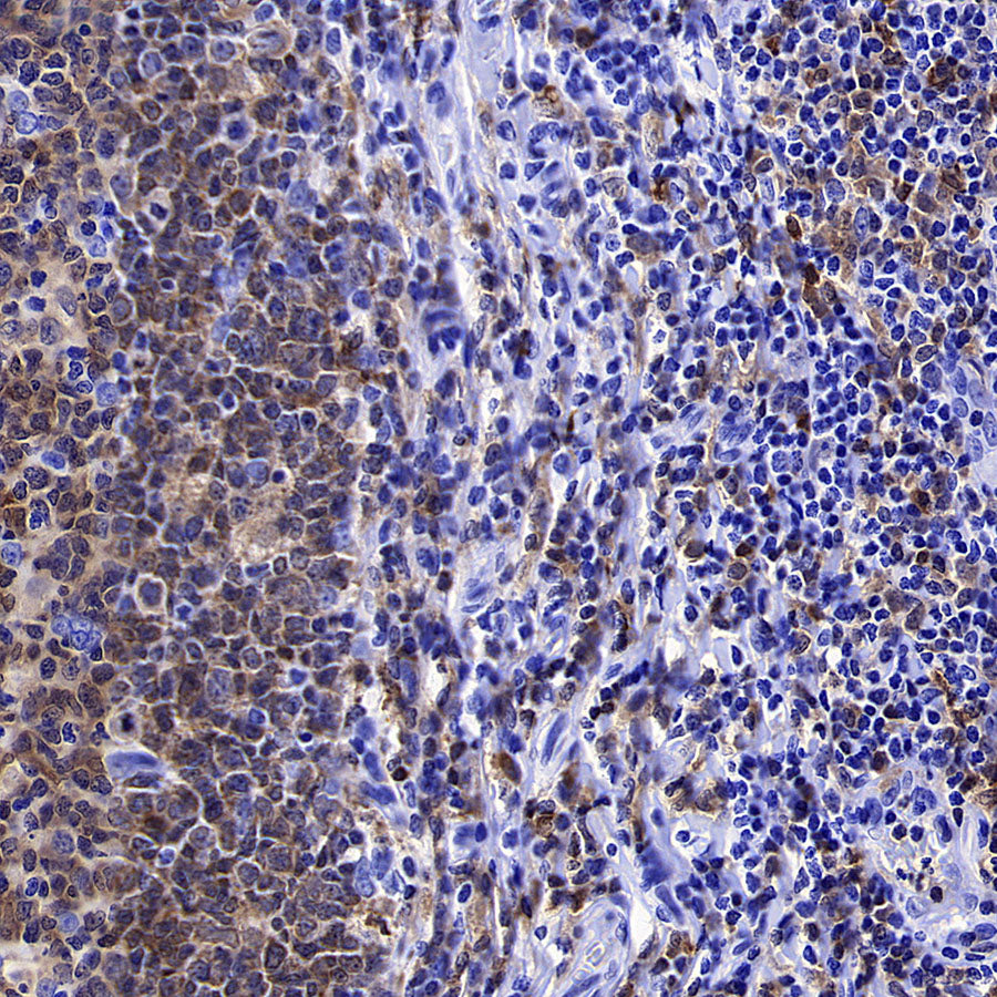 Syk Recombinant Rabbit mAb (S-4400-11)