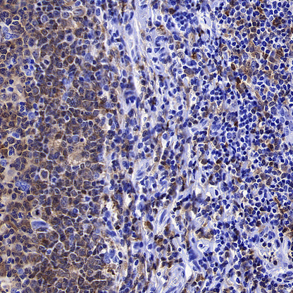 Syk Recombinant Rabbit mAb (S-4400-11)