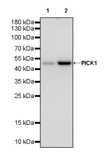 PICK1 Recombinant Rabbit mAb (S-2346-165)
